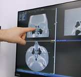 Sinus CT Scan in Hollywood, Florida | ENT Family